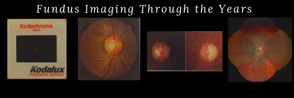 Fundus Imaging Through the Years