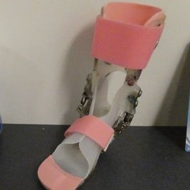 O&P leg brace